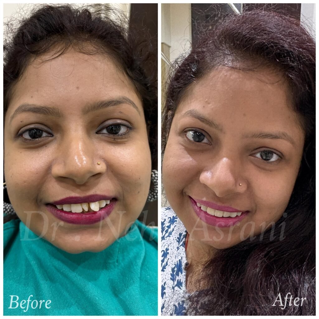 Before and after: Smile makeover