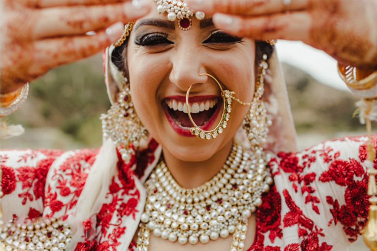 Bridal Smile Makeover at Smileography, Jabalpur