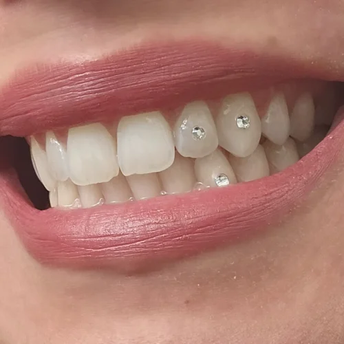 Tooth Jewellery at Smileography, Jabalpur